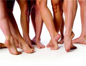 varicoseveins