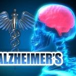 Doctor Discovers Natural Alzheimer Treatment…