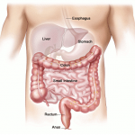 Colon Therapy