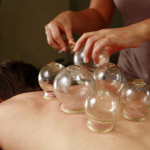 What Is Cupping?