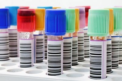 10 Life-saving Blood Tests