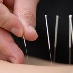 Interview: Acupuncture & Cleansing