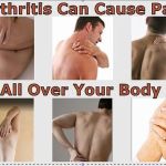 Arthritis – Prevention and Pain Relief