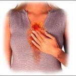 Do You Suffer From Acid Reflux or Heartburn?
