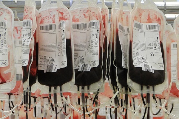 Blood type certainly makes a difference when it comes to blood transfusions.