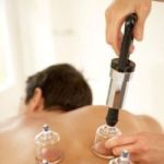 Chinese Cupping Therapy To Detoxify Your Body