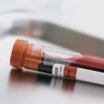 Would You Take Blood Test To Measure Telomeres?