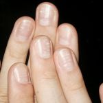 8 Health Warnings Your Fingernails Are Sending
