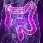 Avoid The Hidden Dangers of Over The Counter Colon Cleanses