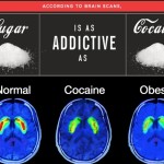 This Is What Happens To Your Brain When You Stop Eating Sugar