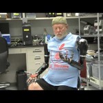 The Bionic Arm That Changed This Man’s Life