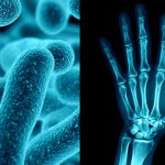 The Ties Between Joint Pain & Gut Bacteria