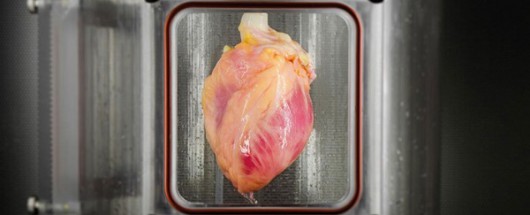artificial heart