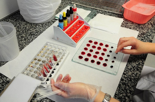 A lab test for blood type.