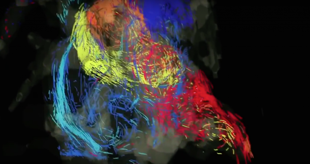 This 3D scan of a patient’s heart is a work of art.