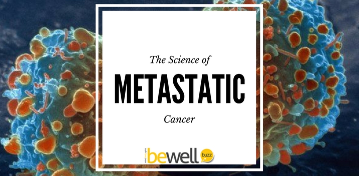 metastatic cancer