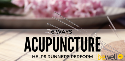 acupuncture benefits