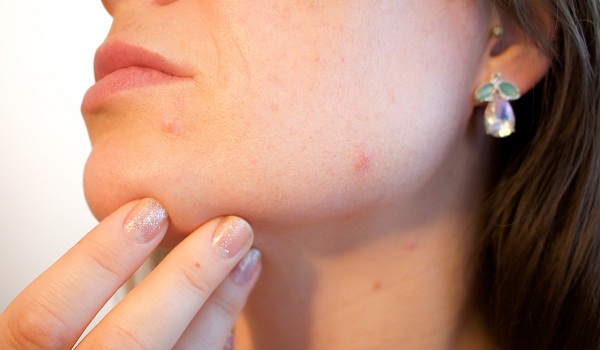 Skin Damaging Habits