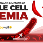 Sickle Cell Anemia: How To Manage Symptoms Naturally