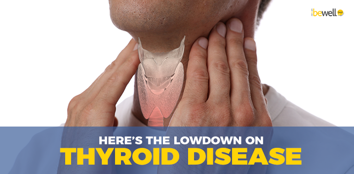 Everything You Need to Know About Hypo- And Hyper-Thyroidism