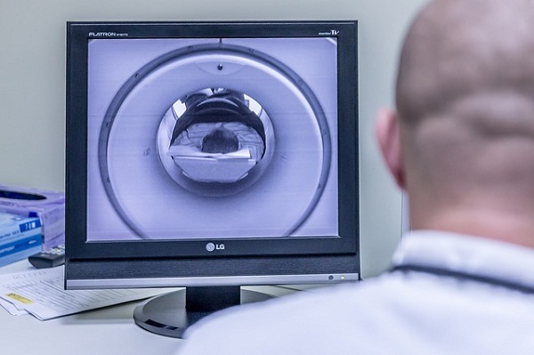 Imaging tests allow experts to look for suspicious areas, to diagnose liver cancer.